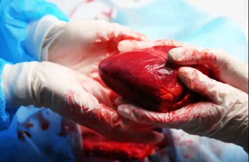 can-a-heart-transplant-transfer-the-donor-s-memories