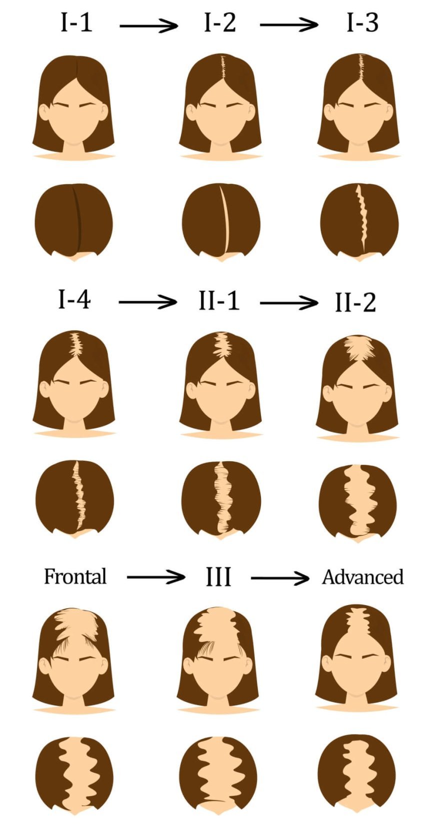 The most common Hair problems and how to solve them