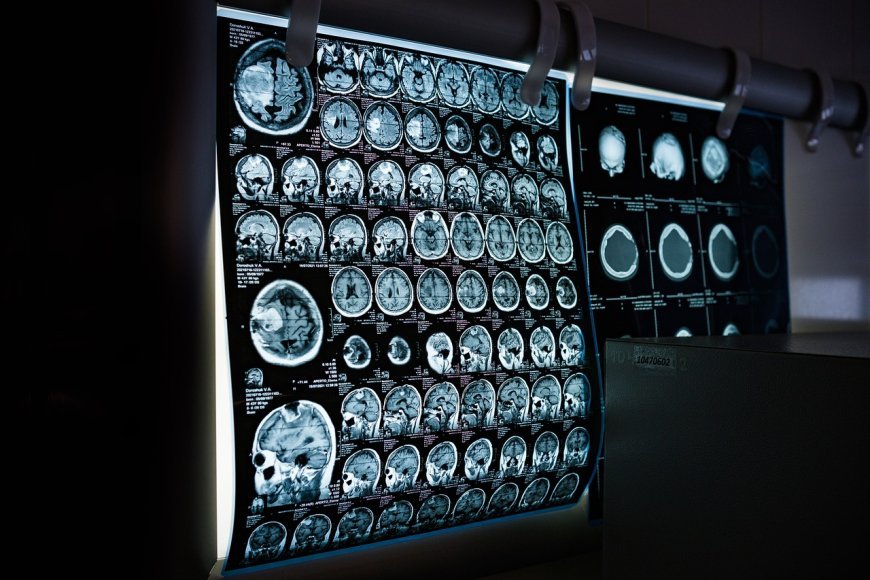 Tumors Key Symptoms, Risk Factors, and Advances in Treatment