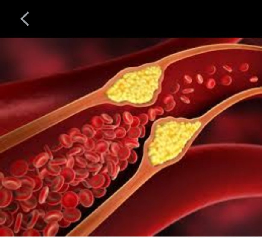 6 Morning Habits to lower high Cholesterol , according to Cardiologist