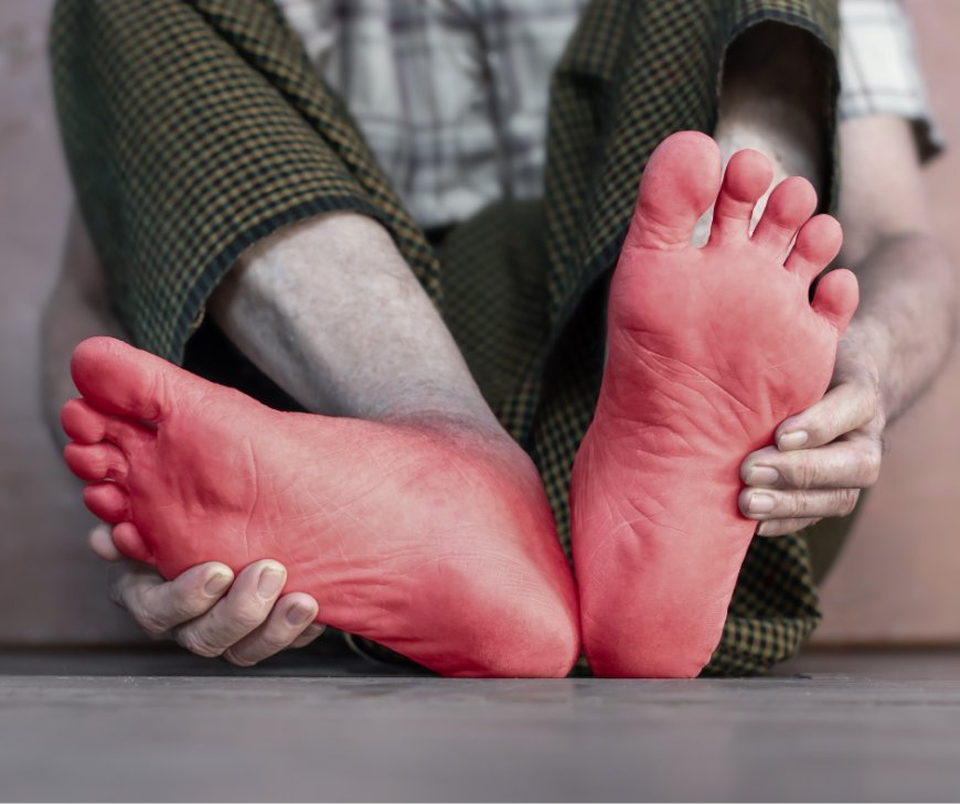 Understanding Burning and Tingling Sensations in the Feet