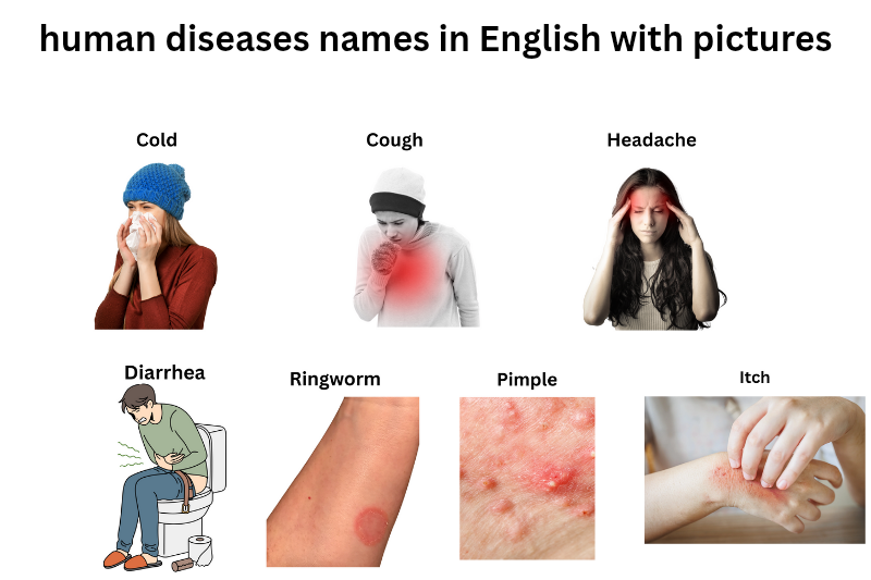 List of human diseases names in English with pictures
