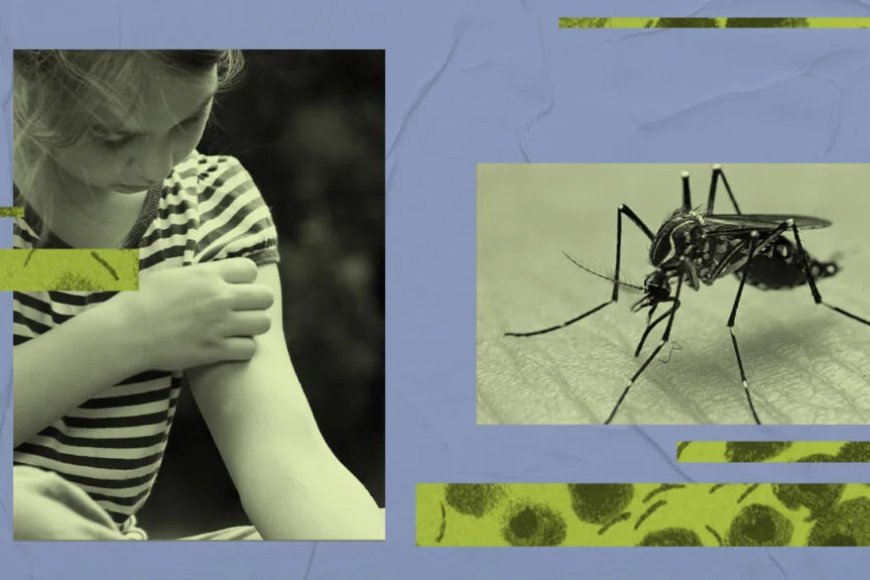 obese children infected at higher risk of dengue fever.