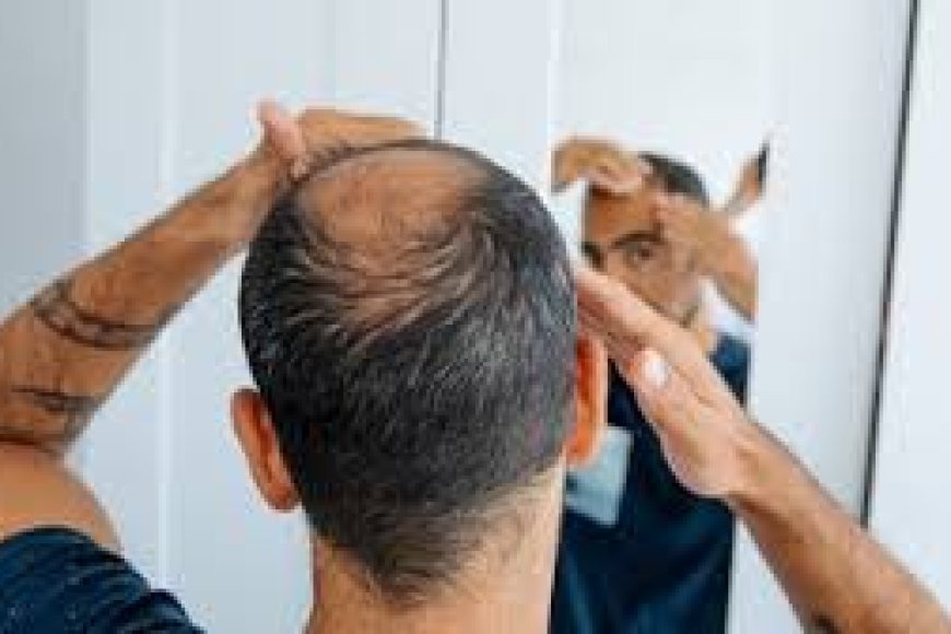 Scientists finally discover sugar that cure male baldness