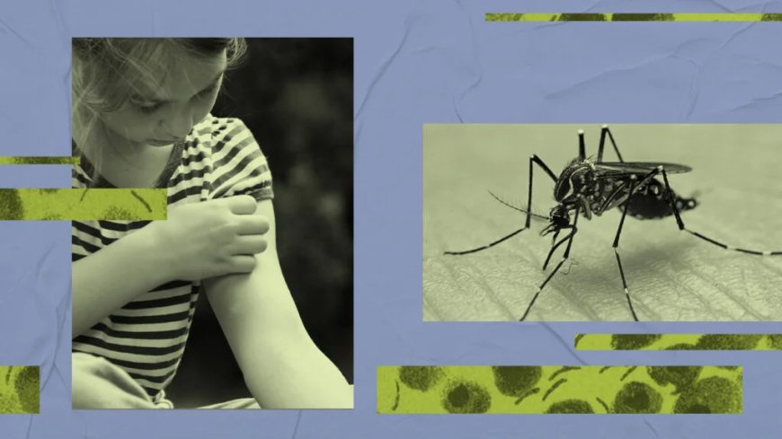 obese children infected at higher risk of dengue fever.