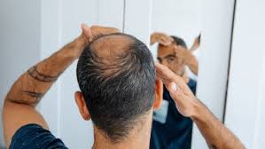 Scientists finally discover sugar that cure male baldness