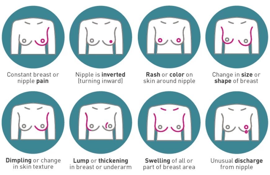 Recognizing the Top Signs and Symptoms of Breast Cancer